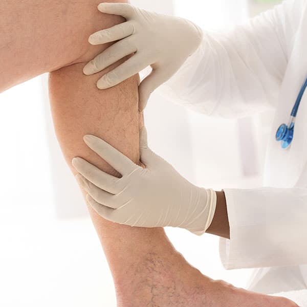 Doctor examining a womens leg for Painless In-Office Venous Surgery in Seattle